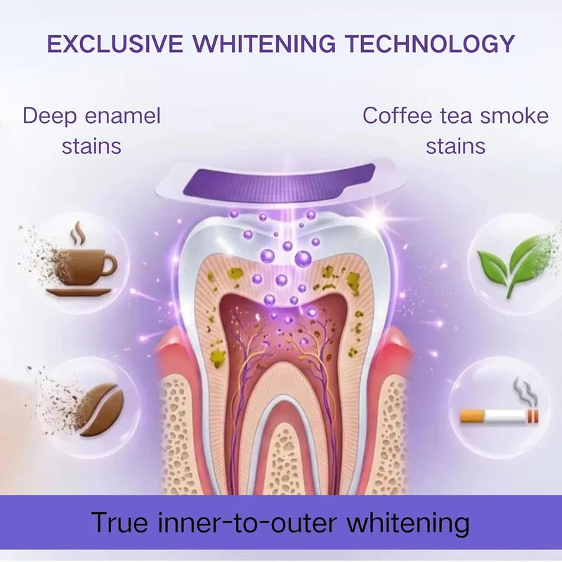 Purple Instant Teeth Whitening Strips – 14 Treatments